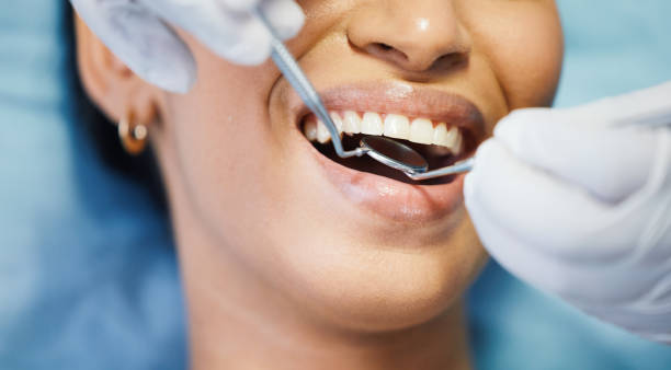 Best Emergency Root Canal Treatment in Jamestown, TN